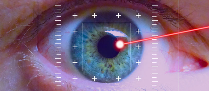 Retina Lasers